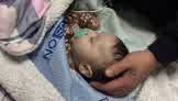 Parents of Windsor baby diagnosed with meningitis say hospital dismissed concerns