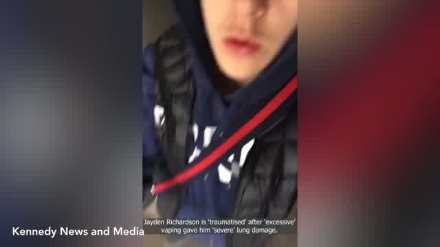 Teen suffers severe lung damage caused by excessive vaping