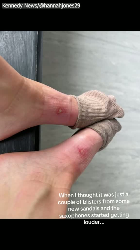 Wales Nurse Hospitalised After Wearing TK Maxx Sandals 'Someone Else Had Worn'