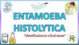Entamoeba Histolytica : Morphology of the Trophozoite & Cyst on Light Microscope (Stools for AOC)