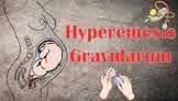 Hyperemesis Gravidarum :- Causes, Signs & Symptoms, Diagnosis & Treatment